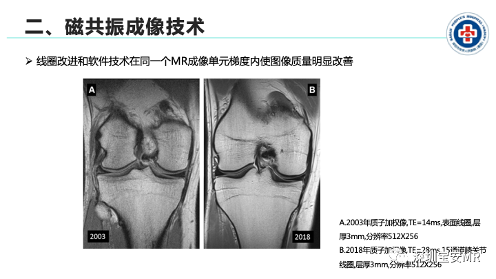 影像PPT - 【PPT】磁共振成像在风湿性疾病中的应用-4