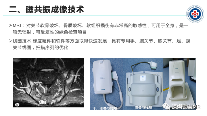 影像PPT - 【PPT】磁共振成像在风湿性疾病中的应用-3