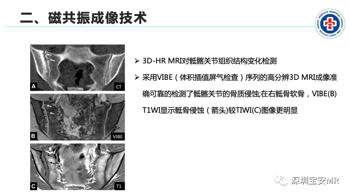 影像PPT - 【PPT】磁共振成像在风湿性疾病中的应用-11