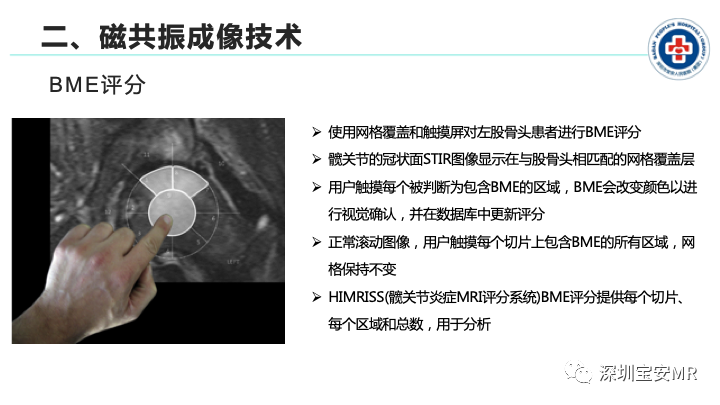 影像PPT - 【PPT】磁共振成像在风湿性疾病中的应用-9