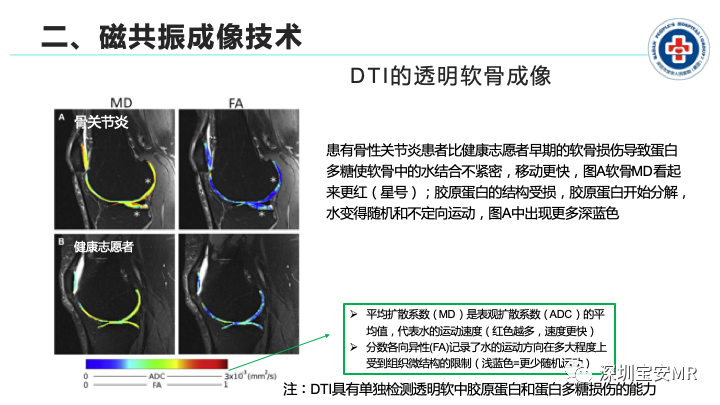 影像PPT - 【PPT】磁共振成像在风湿性疾病中的应用-13