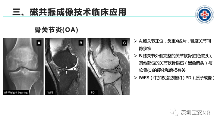 影像PPT - 【PPT】磁共振成像在风湿性疾病中的应用-23