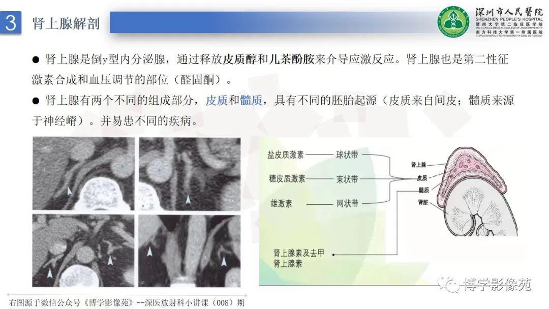 影像PPT - 【PPT】腹膜后间隙及肾上腺常见疾病影像表现-15