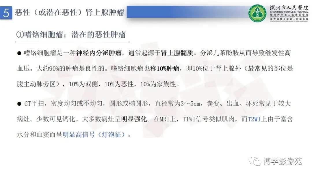 影像PPT - 【PPT】腹膜后间隙及肾上腺常见疾病影像表现-26