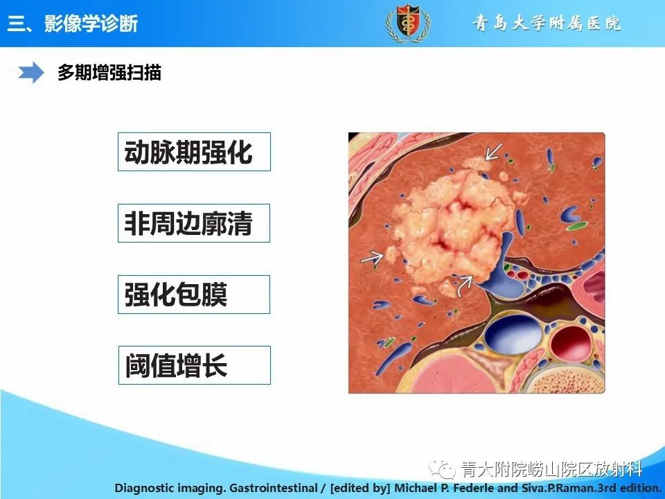 影像PPT - 【病例】肝细胞肝癌1例MR影像-13