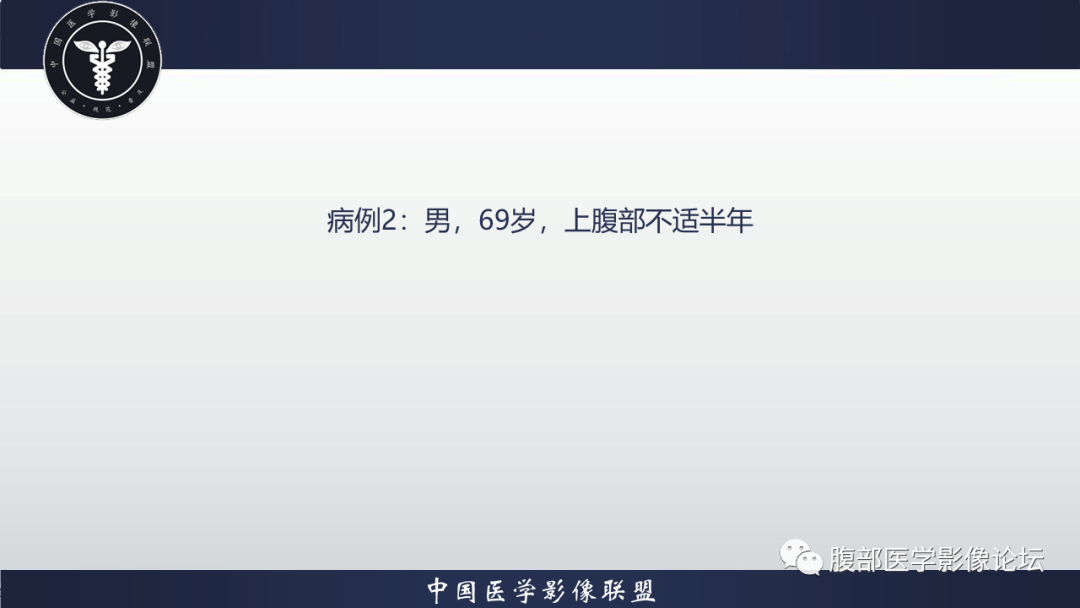 影像PPT - 【病例】肝细胞肝癌1例MR影像-2