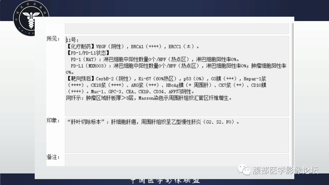 影像PPT - 【病例】肝细胞肝癌1例MR影像-7