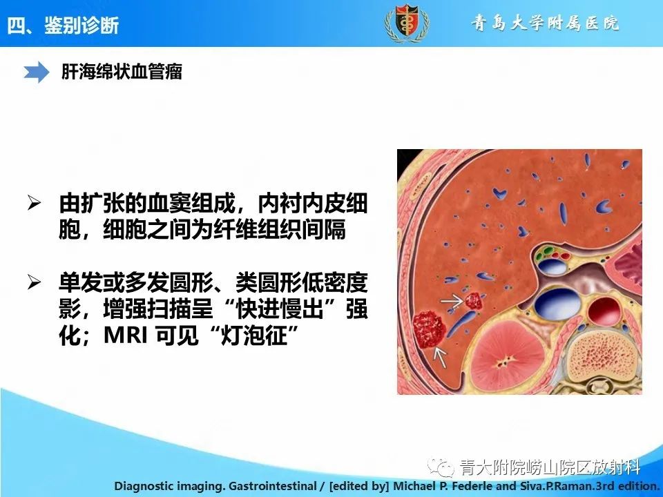 影像PPT - 【病例】肝细胞肝癌1例MR影像-30