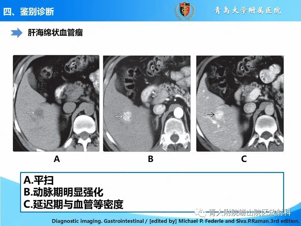 影像PPT - 【病例】肝细胞肝癌1例MR影像-31