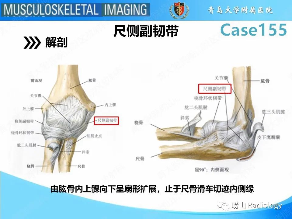 影像PPT - 【PPT】尺侧副韧带撕裂-7