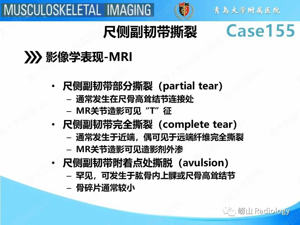 影像PPT - 【PPT】尺侧副韧带撕裂-13