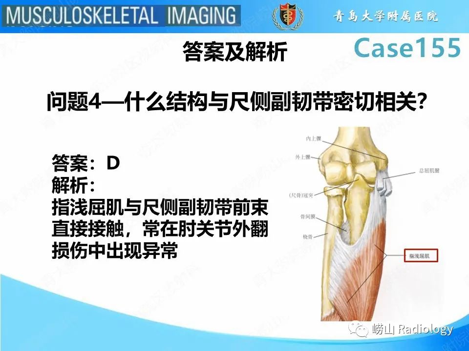 影像PPT - 【PPT】尺侧副韧带撕裂-28