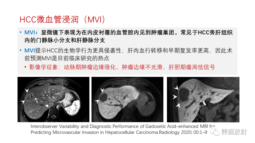 影像PPT - 【PPT】HCC热消融治疗后影像表现解读及报告标准-18