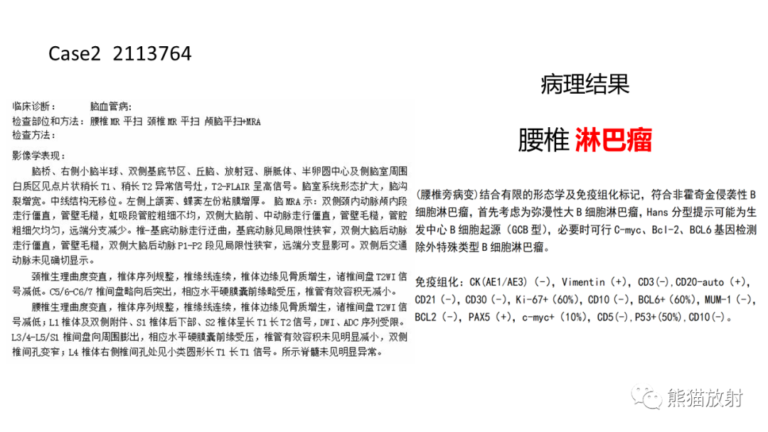 影像PPT - 【病例】椎体浆细胞瘤 VS 淋巴瘤-20