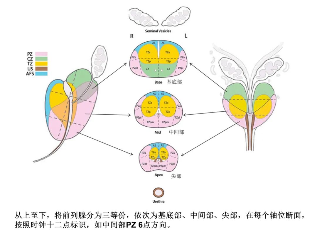 影像PPT - 前列腺磁共振PI-PARS V2.1及正确的报告书写-2 影像PPT - 前列腺磁共振PI-PARS V2.1及正确的报告书写-2
