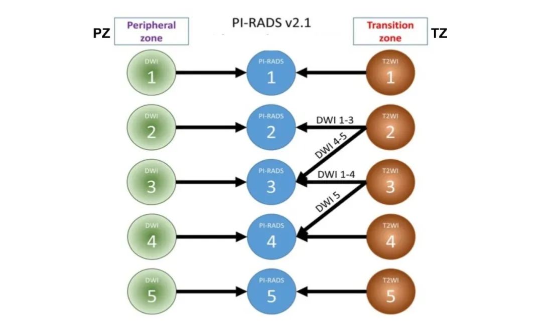 影像PPT - 前列腺磁共振PI-PARS V2.1及正确的报告书写-17 影像PPT - 前列腺磁共振PI-PARS V2.1及正确的报告书写-17