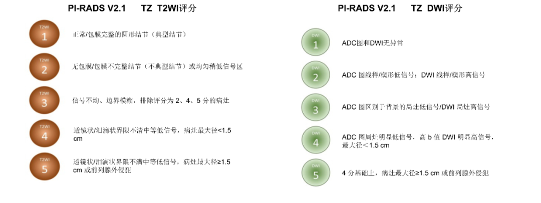 影像PPT - 前列腺磁共振PI-PARS V2.1及正确的报告书写-23 影像PPT - 前列腺磁共振PI-PARS V2.1及正确的报告书写-23