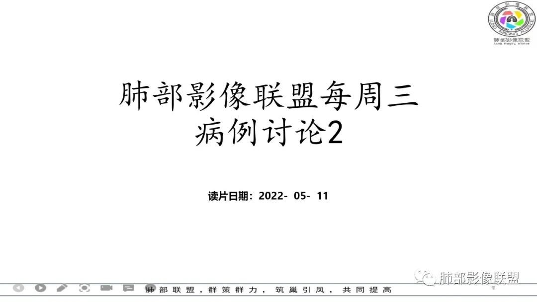 影像PPT - 【病例】 左右为难的肺结节-1 影像PPT - 【病例】 左右为难的肺结节-1