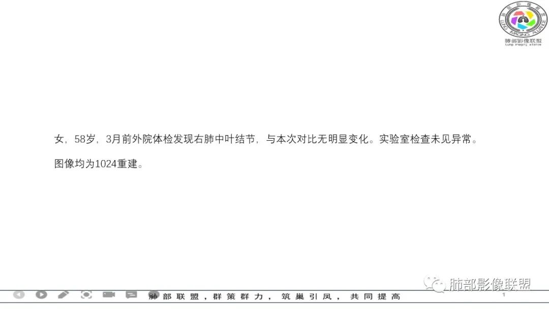 影像PPT - 【病例】 左右为难的肺结节-2 影像PPT - 【病例】 左右为难的肺结节-2