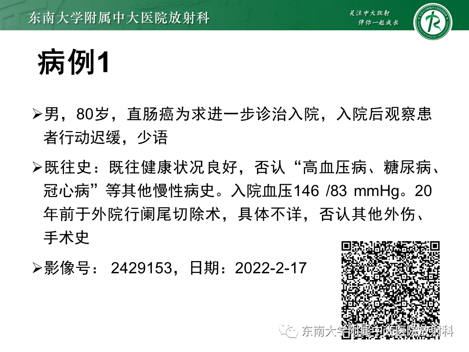 影像PPT - 【PPT】神经系统疑难病例讨论-3
