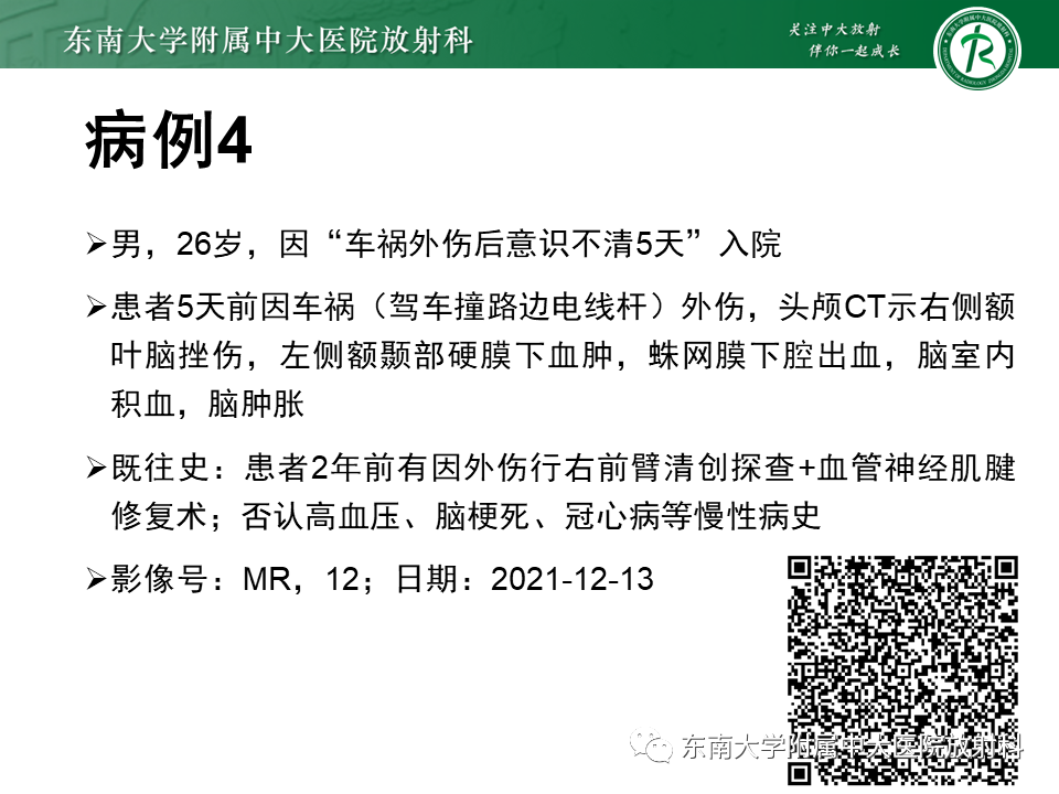 影像PPT - 【PPT】神经系统疑难病例讨论-9