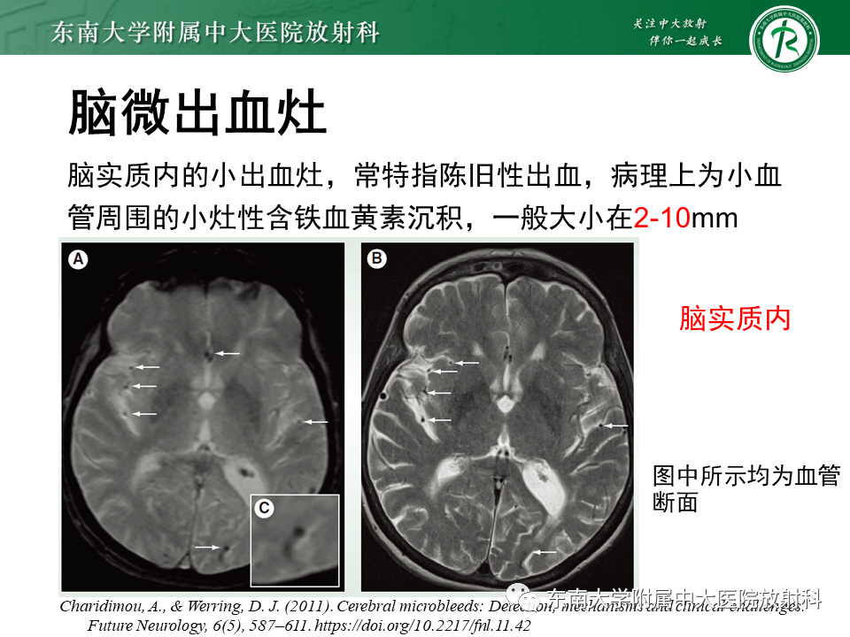 影像PPT - 【PPT】神经系统疑难病例讨论-13