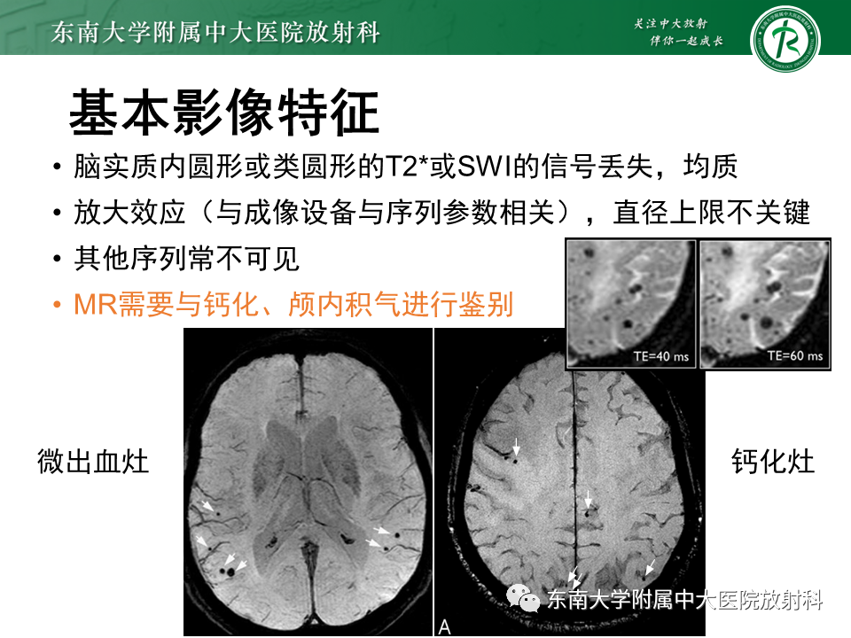 影像PPT - 【PPT】神经系统疑难病例讨论-14