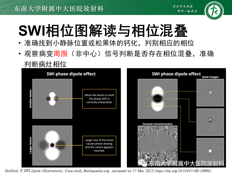 影像PPT - 【PPT】神经系统疑难病例讨论-16