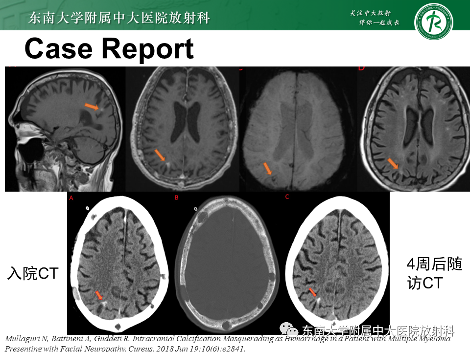 影像PPT - 【PPT】神经系统疑难病例讨论-17
