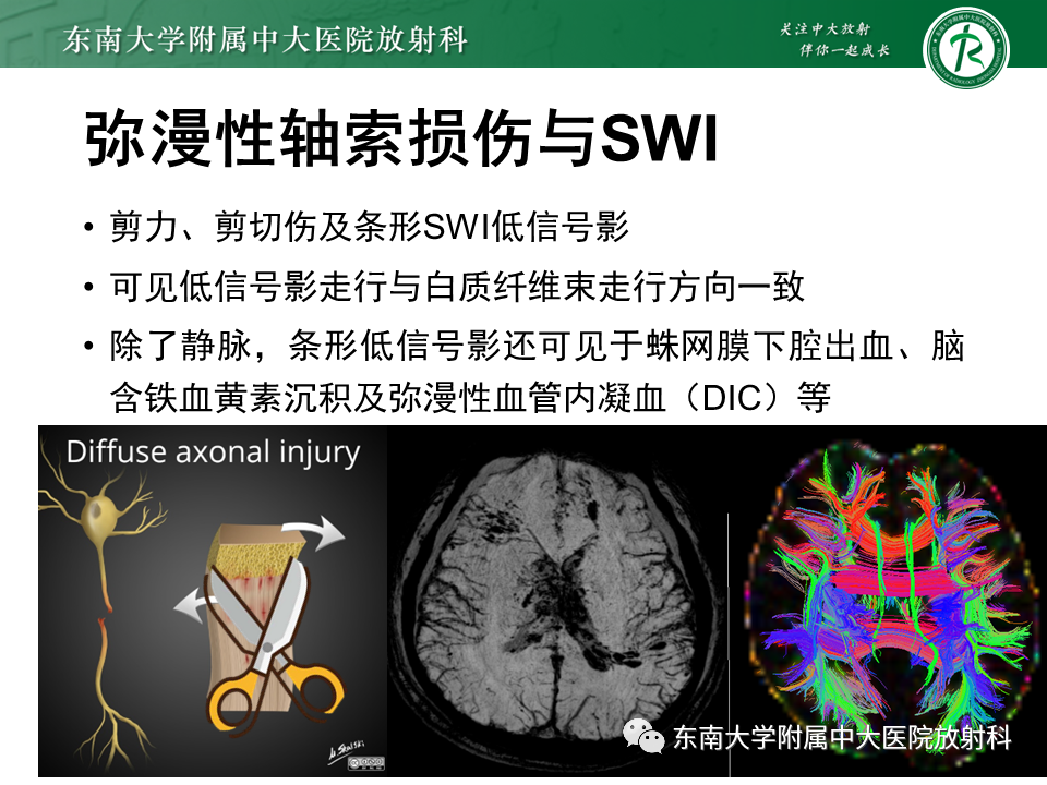 影像PPT - 【PPT】神经系统疑难病例讨论-19