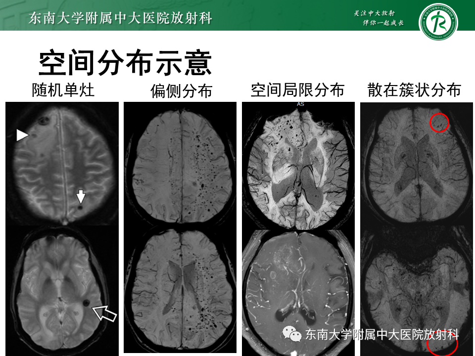 影像PPT - 【PPT】神经系统疑难病例讨论-22