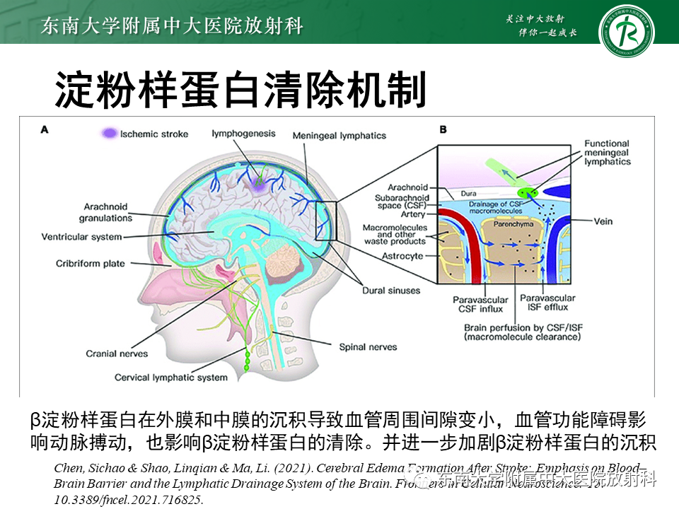 影像PPT - 【PPT】神经系统疑难病例讨论-25