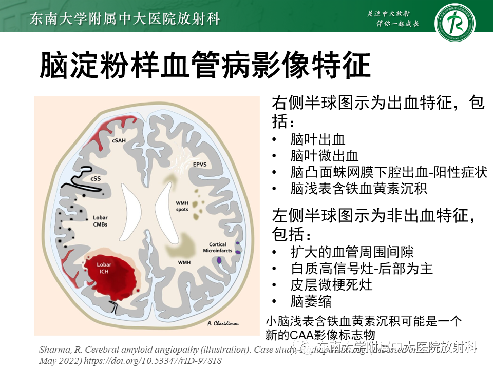 影像PPT - 【PPT】神经系统疑难病例讨论-26
