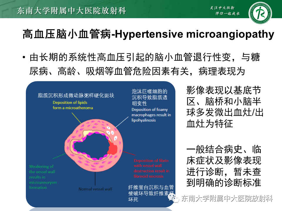 影像PPT - 【PPT】神经系统疑难病例讨论-32