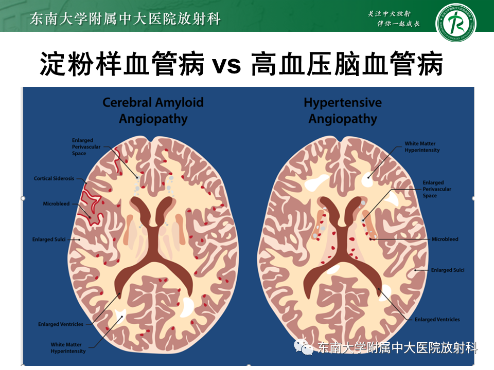 影像PPT - 【PPT】神经系统疑难病例讨论-33