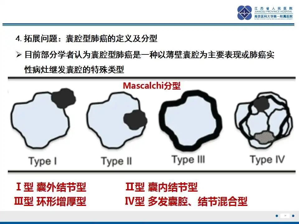 影像PPT - 【PPT】囊腔型肺癌伴胸膜转移-17