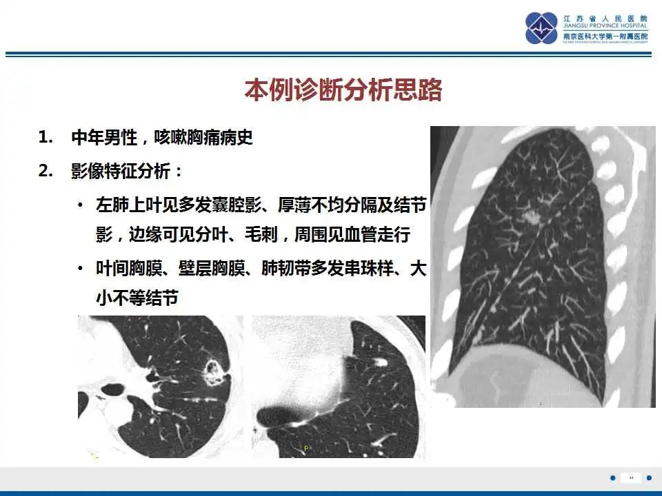 影像PPT - 【PPT】囊腔型肺癌伴胸膜转移-29