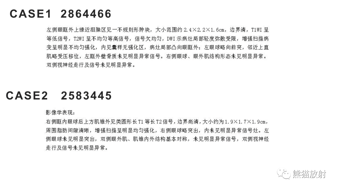 影像PPT - 【病例】泪腺多形性腺瘤2例MR影像-23