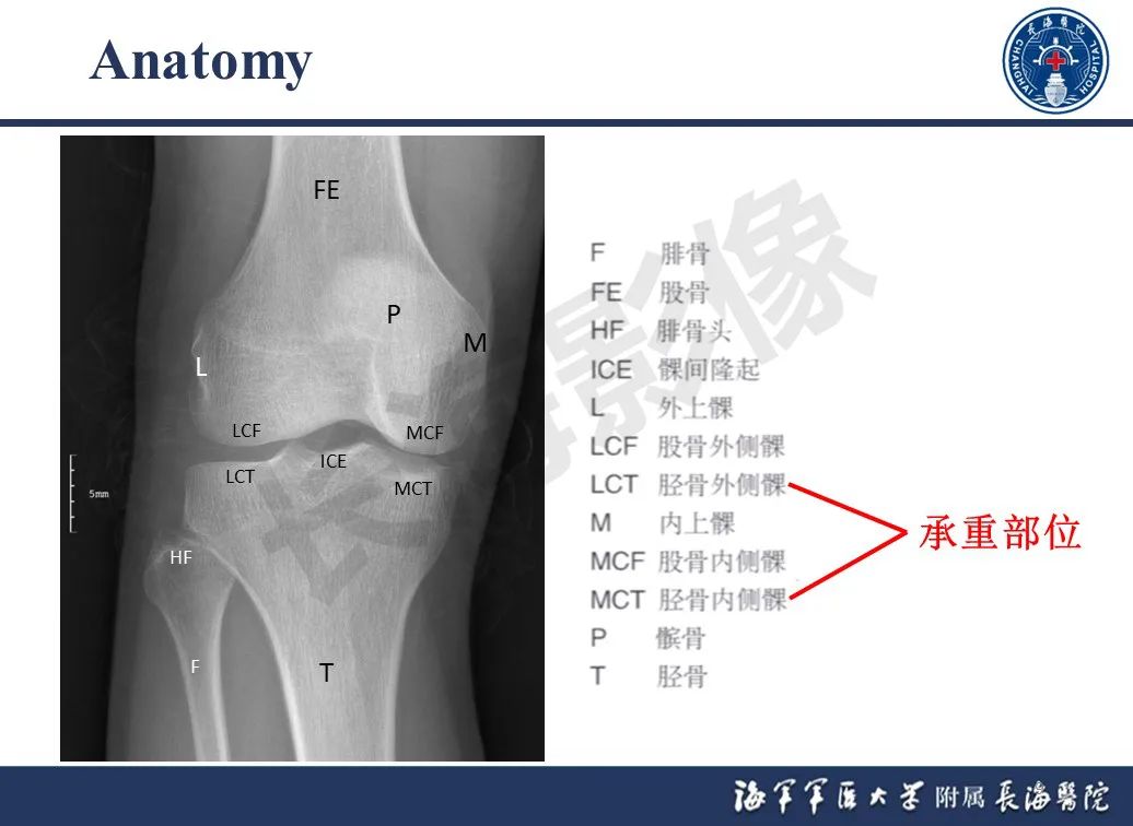 影像PPT - 【PPT】胫骨平台骨折三柱理论：骨科医生想知道什么-9