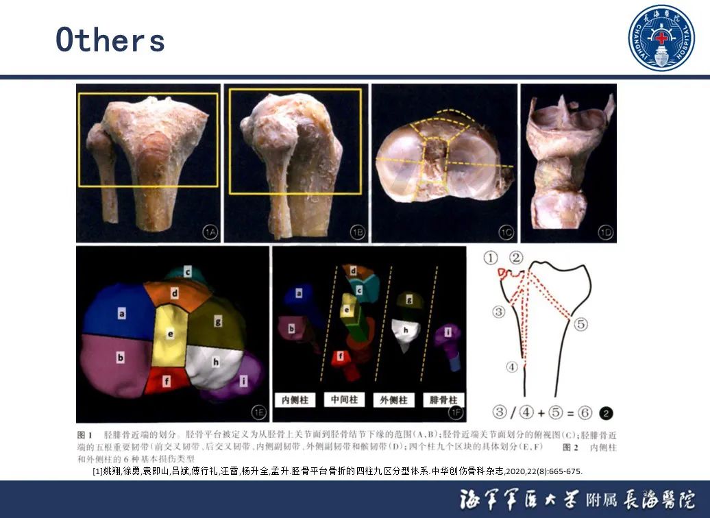 影像PPT - 【PPT】胫骨平台骨折三柱理论：骨科医生想知道什么-38