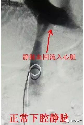 影像PPT - 布加氏综合征肝脏继发改变MRI表现-3 影像PPT - 布加氏综合征肝脏继发改变MRI表现-3