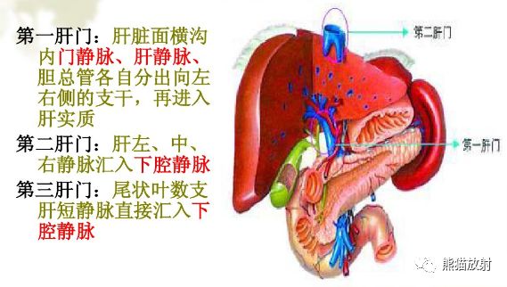 影像PPT - 布加氏综合征肝脏继发改变MRI表现-5 影像PPT - 布加氏综合征肝脏继发改变MRI表现-5