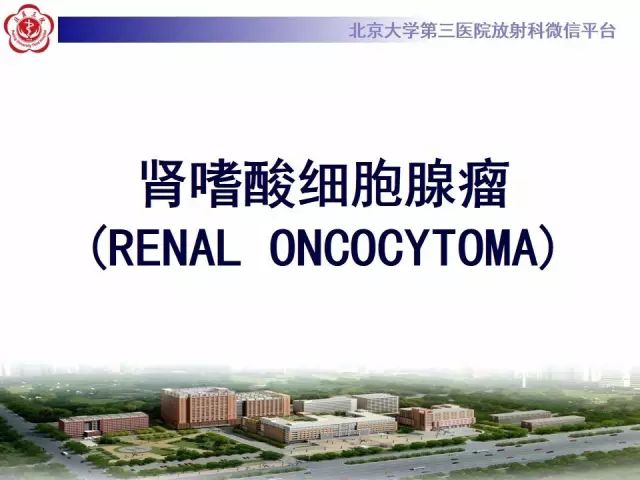 影像PPT - 【病例】肾脏嗜酸细胞瘤1例MR影像-7