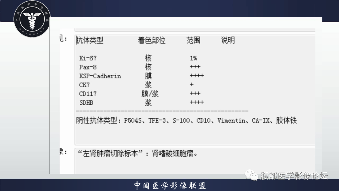 影像PPT - 【病例】肾脏嗜酸细胞瘤1例MR影像-6