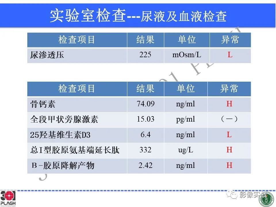 影像PPT - 【病例】鞍区生殖细胞瘤1例MR影像-6