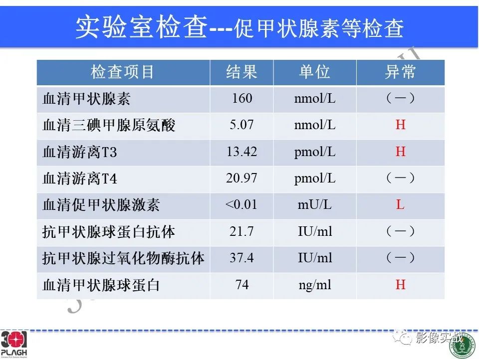 影像PPT - 【病例】鞍区生殖细胞瘤1例MR影像-7