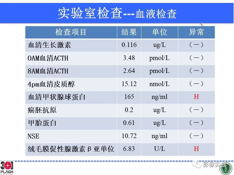 影像PPT - 【病例】鞍区生殖细胞瘤1例MR影像-9