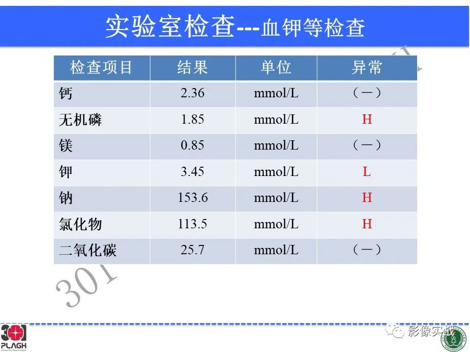 影像PPT - 【病例】鞍区生殖细胞瘤1例MR影像-4