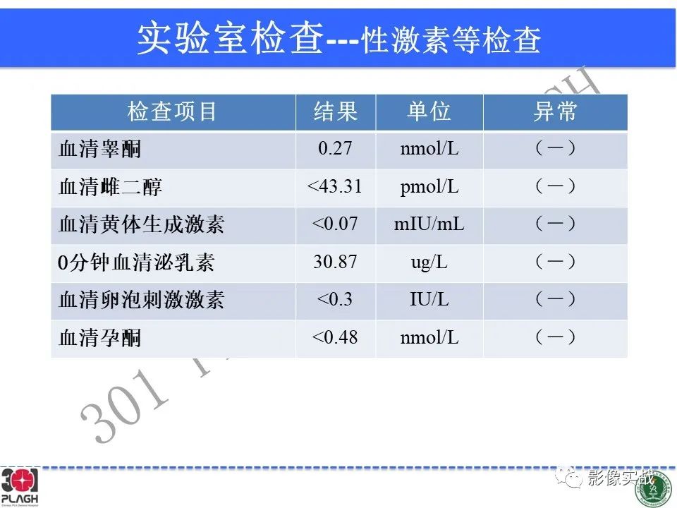 影像PPT - 【病例】鞍区生殖细胞瘤1例MR影像-8