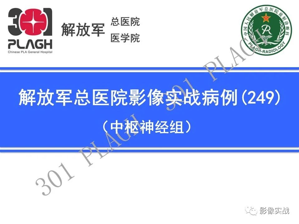 影像PPT - 【病例】鞍区生殖细胞瘤1例MR影像-1